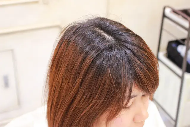 プリンがひどい木村の頭頂部