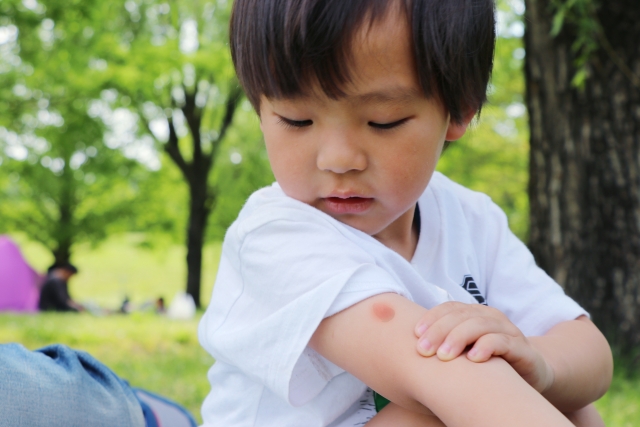 小児科医監修 子供のケガや虫刺されの正しい手当方法は Chintai情報局