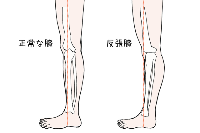 足のむくみの原因は？解消が期待できる生活習慣やマッサージを美容ライターが解説　膝の裏の様子